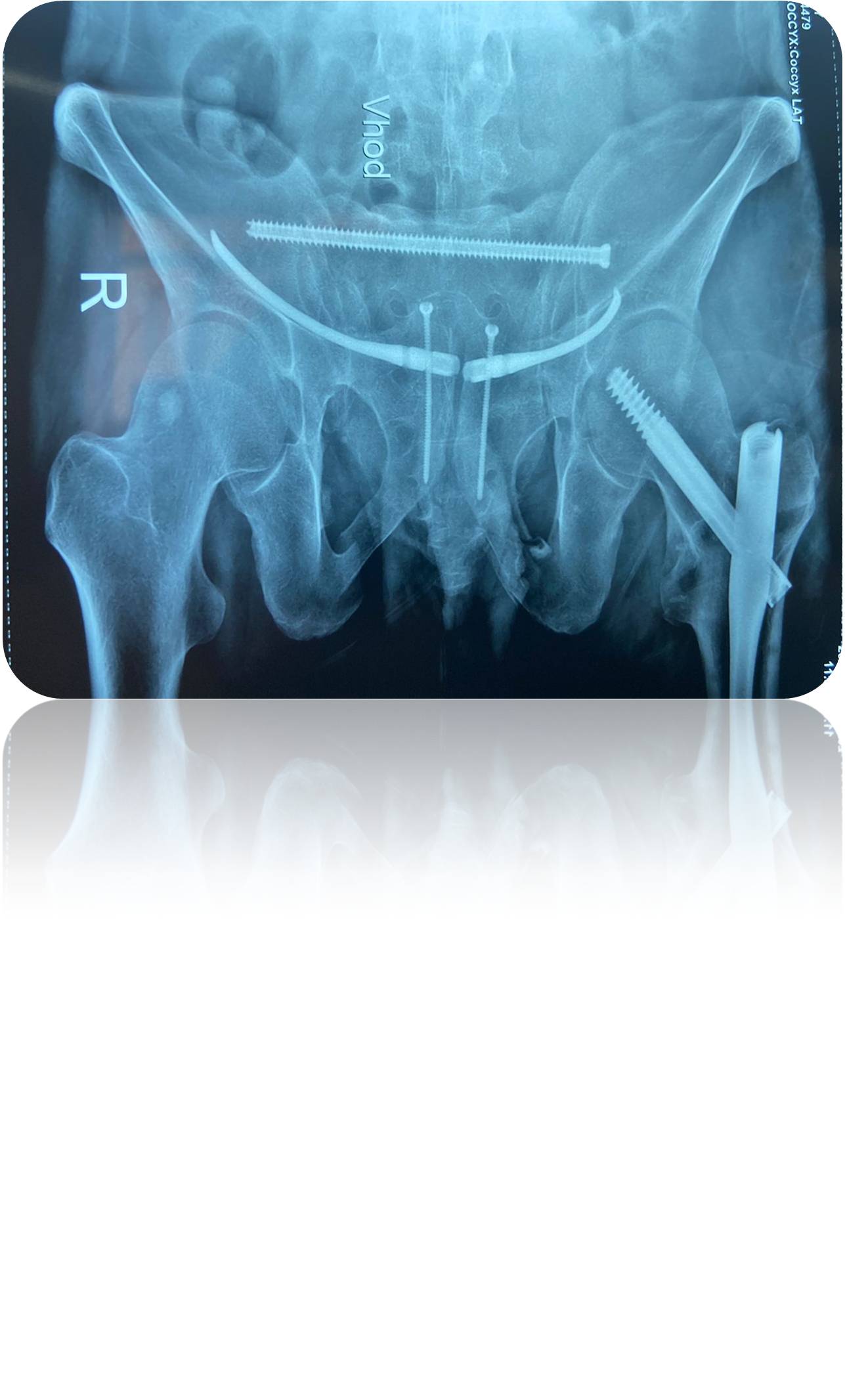 Clinical case