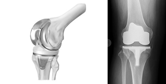 Clinical case