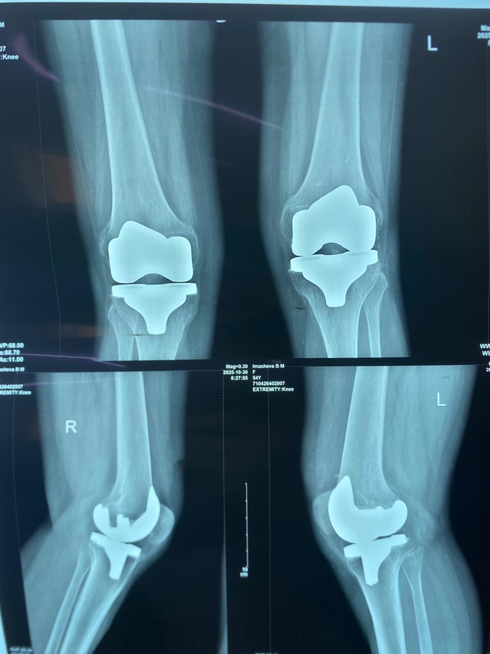 Clinical case