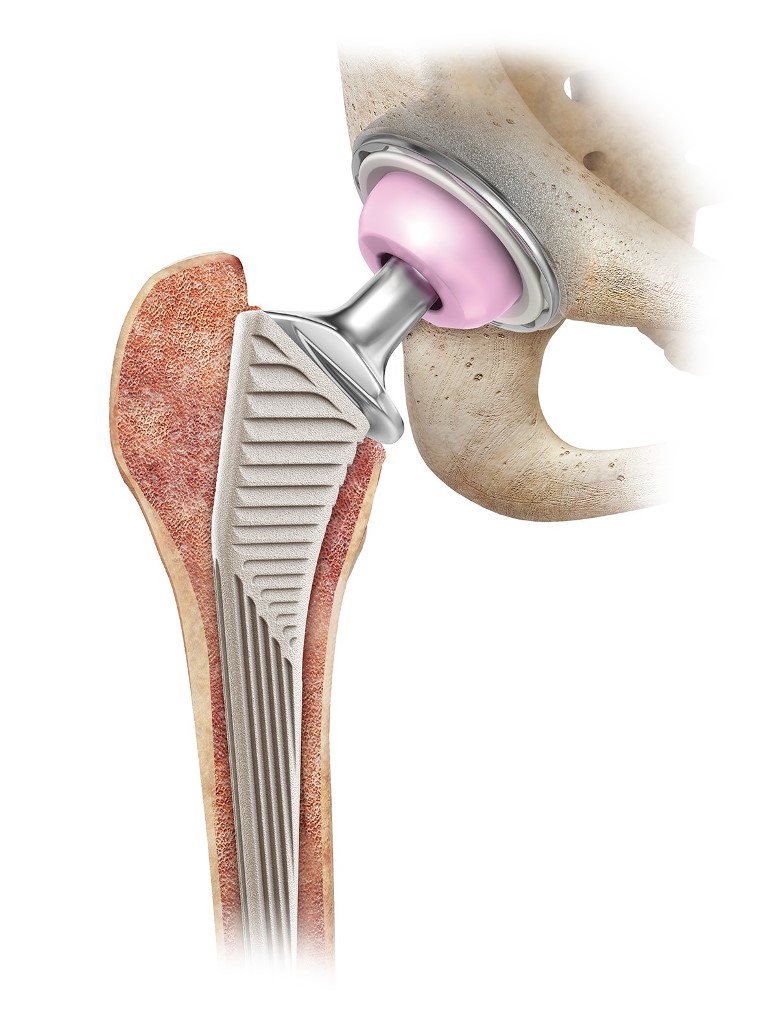 Clinical case