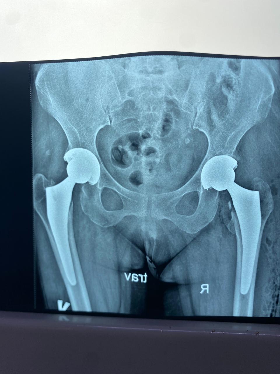 Clinical case
