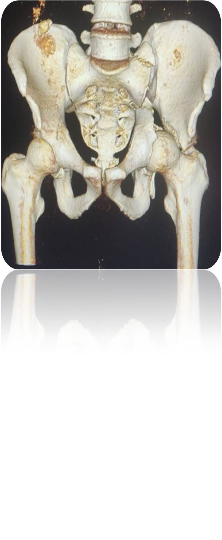 Clinical case
