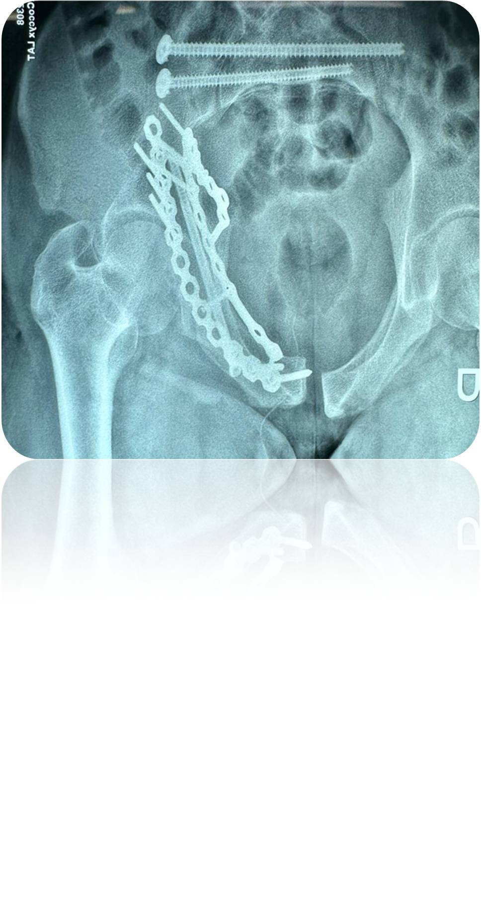 Clinical case