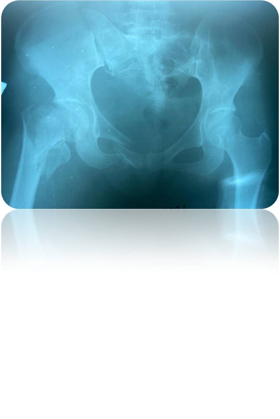 Clinical case