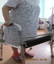 Деформирующий коксартроз
